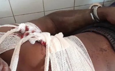 Siguiri : Un jeune orpailleur grièvement blessé lors d’une attaque à main armée à Djibou